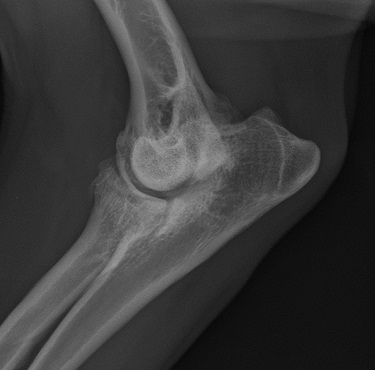 Arthrose_FCP